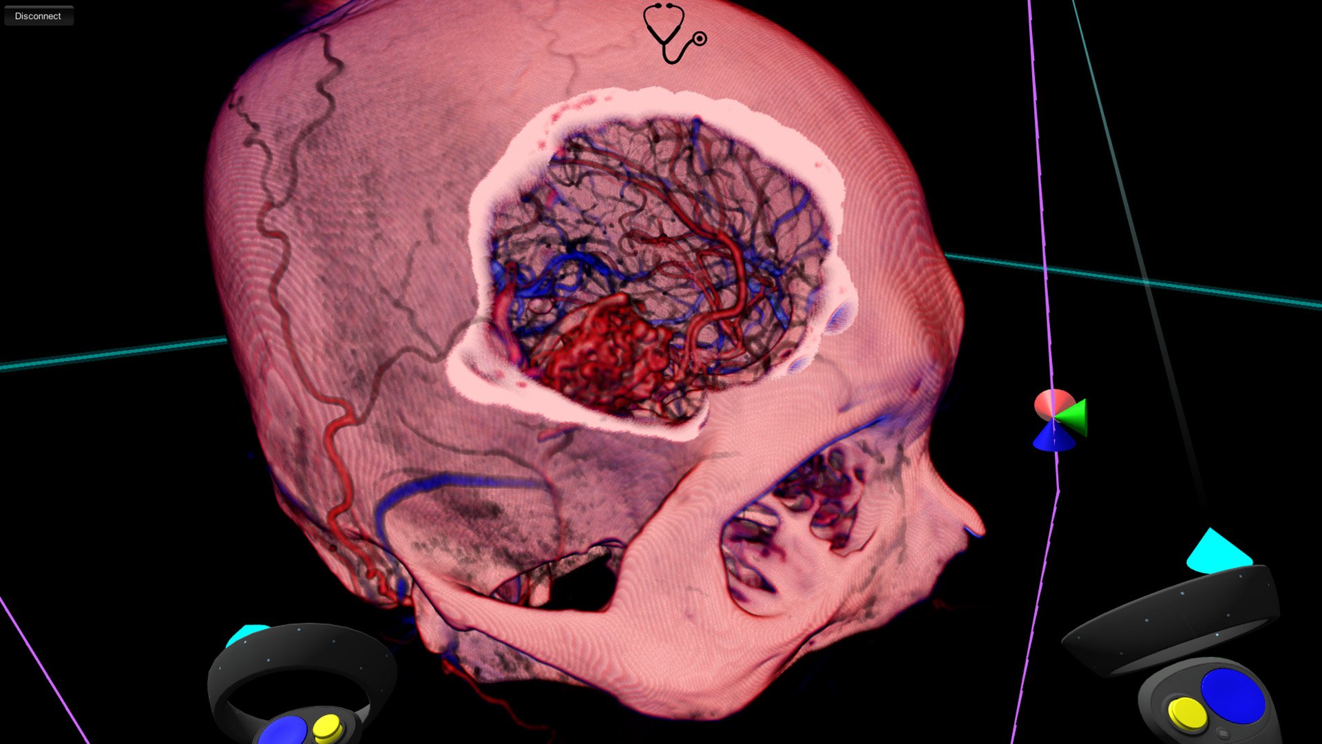 Virtual Reality Modeling for Case-Specific Presurgical Virtual Reality Modeling for Case-Specific Presurgical